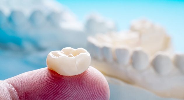 A woman about to receive dental crowns