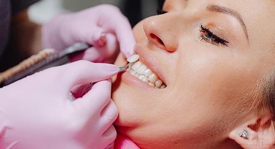 Woman at dentist for veneers